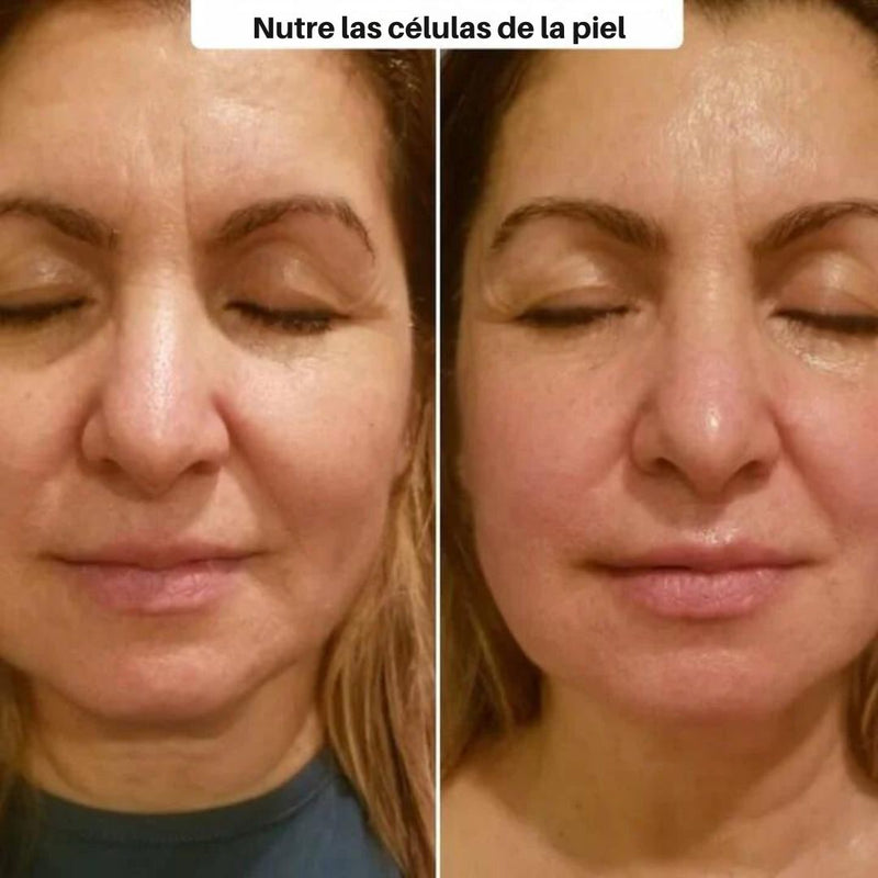 SculptVisage Pro™ - Masajeador Facial